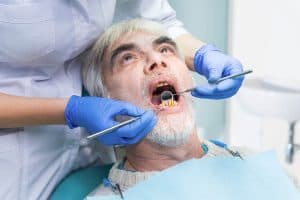 Bad Teeth Affect Health