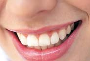 Pleasanton Ca Dental Implant Care