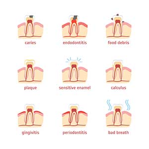 Dental Problem Chart