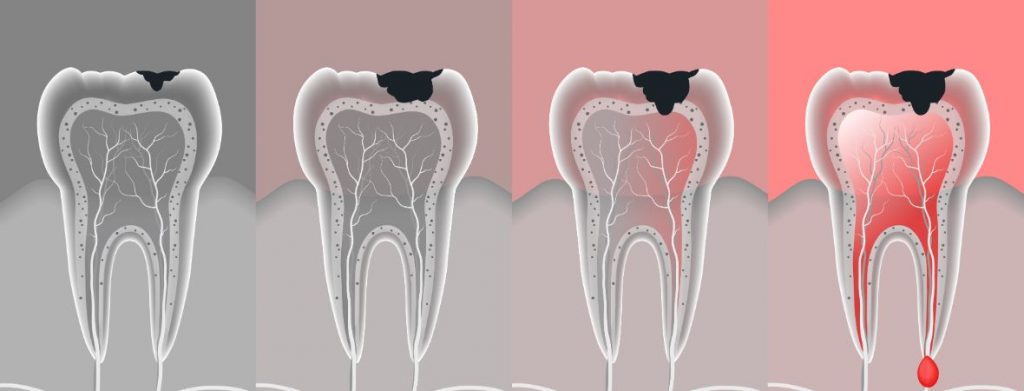 Dental Pulp