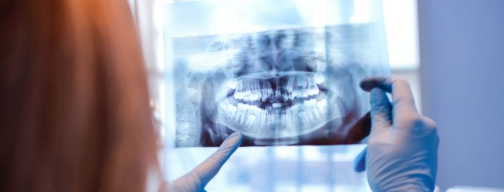 Dental XRay