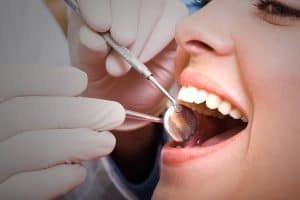 Pleasanton Dental Check Ups