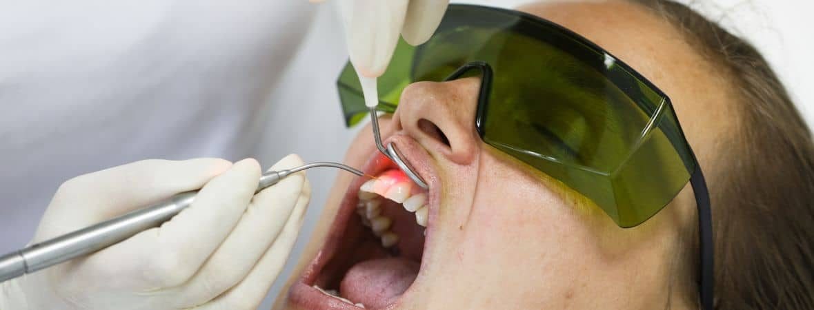 Laser Gum Recontouring