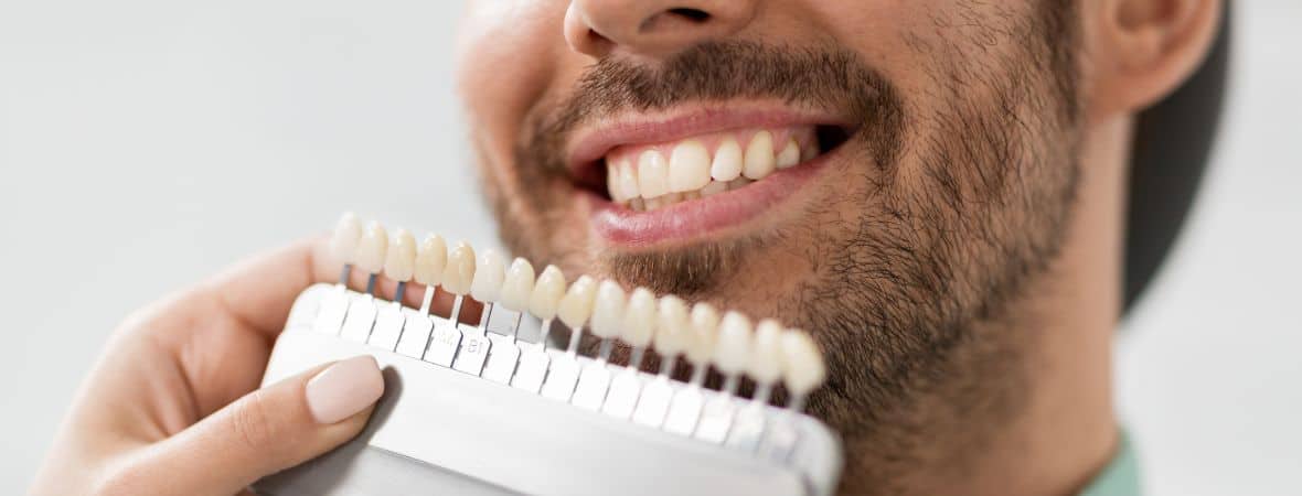 Lumineers Vs Veneers in Pleasanton, CA Gateway Dental Care