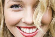 Pleasanton Ca Dental Implant Care