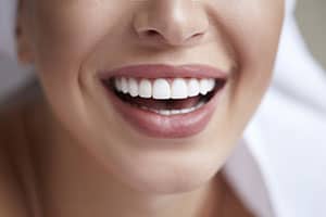Teeth Whitening After Braces